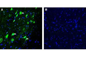Expression of SLC38A2 in rat spinal cord.
