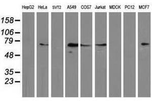Image no. 2 for anti-Mahogunin, Ring Finger 1 (MGRN1) antibody (ABIN1499459) (Mahogunin RING Finger Protein 1 抗体)