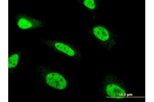 Immunofluorescence of monoclonal antibody to ZNF71 on HeLa cell. (ZNF71 抗体  (AA 1-100))