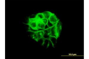 Immunofluorescence of monoclonal antibody to JUP on A-431 cell.