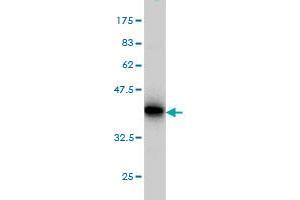 Western Blotting (WB) image for anti-STT3, Subunit of The Oligosaccharyltransferase Complex, Homolog A (STT3A) (AA 603-701) antibody (ABIN561563)