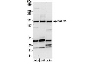 anti-Partner and Localizer of BRCA2 (PALB2) (AA 200-250) antibody