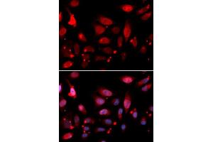 Immunofluorescence analysis of U2OS cells using RACGAP1 antibody (ABIN5973044). (RACGAP1 抗体)