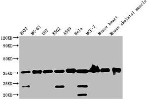 Western Blot Positive WB detected in: Mouse skeletal muscle tissue All lanes: ANKRD23 antibody at 2. (ANKRD23 抗体  (AA 1-200))