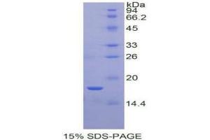 SDS-PAGE (SDS) image for Periostin (POSTN) (AA 97-230) protein (His tag) (ABIN1171086) (Periostin Protein (POSTN) (AA 97-230) (His tag))