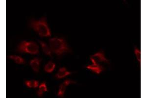 Immunofluorescence (fixed cells) (IF/ICC) image for anti-ATP Synthase, H+ Transporting, Mitochondrial F0 Complex, Subunit S (Factor B) (ATP5S) (Internal Region) antibody (ABIN6258540)