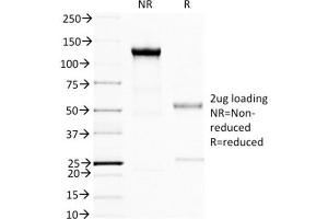 SDS-PAGE Analysis Purified BRCA1 Mouse Monoclonal Antibody (BRCA1/1398). (BRCA1 抗体  (AA 445-620))