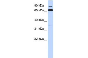 WB Suggested Anti-IKBKB Antibody Titration:  0. (IKBKB 抗体  (Middle Region))