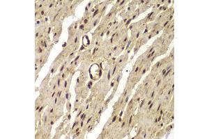 Immunohistochemistry of paraffin-embedded human colon using PSMB8 antibody at dilution of 1:100 (x400 lens). (PSMB8 抗体)