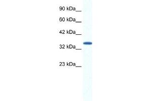 WB Suggested Anti-AIP Antibody Titration:  1. (AIP 抗体  (N-Term))