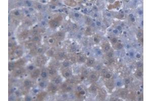 DAB staining on IHC-P; Samples: Rat Liver Tissue (SLC25A20 抗体  (AA 1-211))