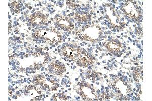 Immunohistochemistry (IHC) image for anti-Arginase, Liver (ARG1) (N-Term) antibody (ABIN2773866) (Liver Arginase 抗体  (N-Term))