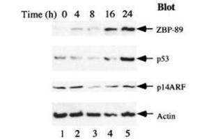 Serum starvation induces ZBP-89 and p53 expression. (ZNF148 抗体)