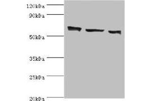 Western blot All lanes: COIL antibody at 3 μg/mL Lane 1: MCF-7 whole cell lysate Lane 2: Hela whole cell lysate Lane 3: HepG2 whole cell lysate Secondary Goat polyclonal to rabbit IgG at 1/10000 dilution Predicted band size: 63 kDa Observed band size: 63 kDa (Coilin 抗体  (AA 297-576))