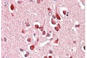 Image no. 1 for anti-Unc-5 Homolog C (C. Elegans) (Unc5c) (Internal Region) antibody (ABIN452309) (Unc5c 抗体  (Internal Region))