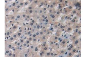 Immunohistochemistry (IHC) image for anti-Advanced Glycosylation End Product-Specific Receptor (AGER) (AA 1-237) antibody (ABIN7441463)