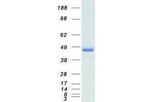 TNF Receptor-Associated Factor 1 (TRAF1) protein (Myc-DYKDDDDK Tag)