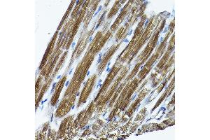 Immunohistochemistry of paraffin-embedded rat heart using ICMT Rabbit pAb (ABIN6128077, ABIN6142129, ABIN6142130 and ABIN6214491) at dilution of 1:200 (40x lens). (ICMT 抗体  (AA 175-284))