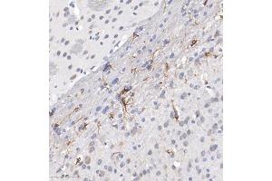 Immunohistochemistry of paraffin embedded mouse brain using ACyclaseI (ABIN7072958) at dilution of 1:650 (300x lens) (ADCY1 抗体)