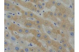 DAB staining on IHC-P; Samples: Human Liver Tissue (SHB 抗体  (AA 252-507))