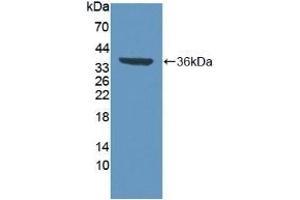 Detection of Recombinant VCP, Human using Polyclonal Antibody to Valosin Containing Protein (VCP) (VCP 抗体  (AA 125-371))