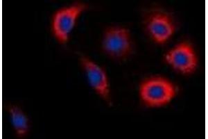 Immunofluorescent analysis of EGFR (pY1016) staining in Jurkat cells. (EGFR 抗体  (C-Term, pTyr1016))