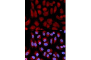 Immunofluorescence analysis of U2OS cell using TAP2 antibody. (TAP2 抗体  (AA 430-680))