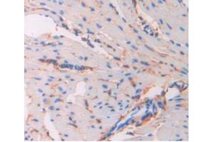 IHC-P analysis of Mouse Heart Tissue, with DAB staining. (CD34 抗体  (AA 36-287))