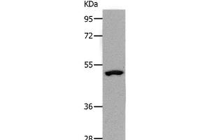 Western Blot analysis of Human lymphoma tissue using NDRG1 Polyclonal Antibody at dilution of 1:1000 (NDRG1 抗体)