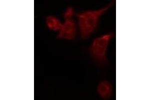 ABIN6276009 staining 293T by IF/ICC. (G Protein-Coupled Receptor 133 抗体)
