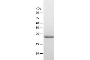 Western Blotting (WB) image for Linker For Activation of T Cells Family, Member 2 (LAT2) (AA 27-243) protein (His tag) (ABIN7288742) (LAT2 Protein (AA 27-243) (His tag))