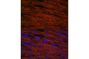 Immunofluorescence analysis of rat heart cells using LDB3 antibody (ABIN6128179, ABIN6143125, ABIN6143126 and ABIN6223347) at dilution of 1:100.