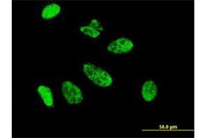 Immunofluorescence of monoclonal antibody to CDX1 on HeLa cell. (CDX1 抗体  (AA 126-215))