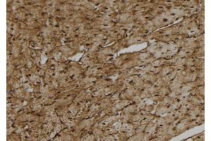 ABIN6278836 at 1/100 staining Rat heart tissue by IHC-P.