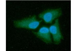 ICC/IF analysis of LDHB in HeLa cells line, stained with DAPI (Blue) for nucleus staining and monoclonal anti-human LDHB antibody (1:100) with goat anti-mouse IgG-Alexa fluor 488 conjugate (Green). (LDHB 抗体)