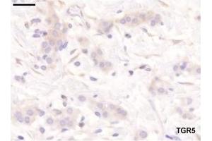 Staining pattern of the antibodies used in the study. (GPBAR1 抗体  (C-Term))