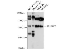 Western blot analysis of extracts of various cell lines, using  antibody (ABIN7265486) at 1:1000 dilution. (arfgap2 抗体  (AA 242-521))