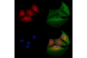 ABIN6257124 and ABIN6275080 staining  cells by IF/ICC.