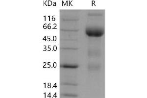 Western Blotting (WB) image for Fms-Related Tyrosine Kinase 4 (FLT4) (Active) protein (Fc Tag) (ABIN7195829)
