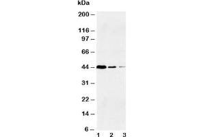 Western blot testing of Caspase-1 antibody and Lane 1:  Jurkat;  2: Raji;  3: CEM (Caspase 1 抗体  (Large Subunit, N-Term))