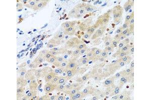 Immunohistochemistry of paraffin-embedded Human liver using RGS5 Polyclonal Antibody at dilution of 1:100 (40x lens). (RGS5 抗体)