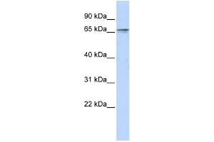 WB Suggested Anti-ZNF192 Antibody Titration:  0. (ZNF192 抗体  (Middle Region))