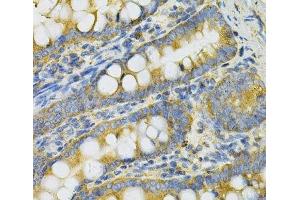 Immunohistochemistry of paraffin-embedded Rat intestine using PGK1 Polyclonal Antibody at dilution of 1:100 (40x lens). (PGK1 抗体)