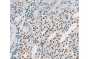 Used in DAB staining on fromalin fixed paraffin- embedded Kidney tissue (YAF2 抗体  (AA 1-180))