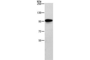 Western Blot analysis of Human brain malignant glioma tissue using TRAF3IP1 Polyclonal Antibody at dilution of 1:500 (TRAF3IP1 抗体)