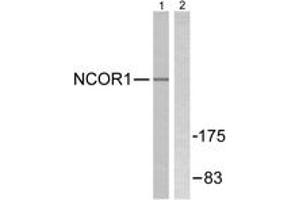 Western blot analysis of extracts from MDA-MB-435 cells, using NCoR1 Antibody. (NCOR1 抗体  (AA 51-100))