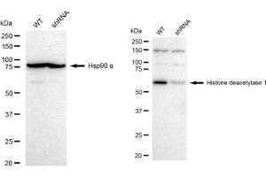 Western blotting analysis using Histone deacetylase 1 antibody (ABIN7798925). (Recombinant HDAC1 抗体)