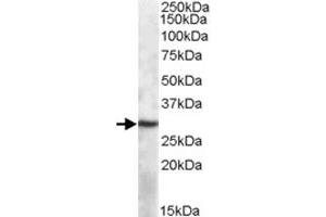 APOBEC1 polyclonal antibody  (1 ug/mL) staining of mouse spleen lysate (35 ug protein in RIPA buffer). (APOBEC1 抗体)