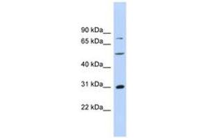 Image no. 1 for anti-Aspartate beta-Hydroxylase (ASPH) (AA 287-336) antibody (ABIN6744502)