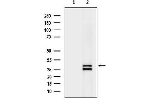 anti-Stanniocalcin 1 (STC1) (C-Term) antibody